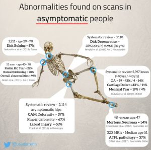 asymptomatic scans